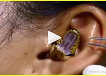 Snakes-Enter-In-Girl-Ear