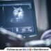 Illegal sex determination racket reaches Maval Srirampur police seize illegal sonography machine in Vadgaon